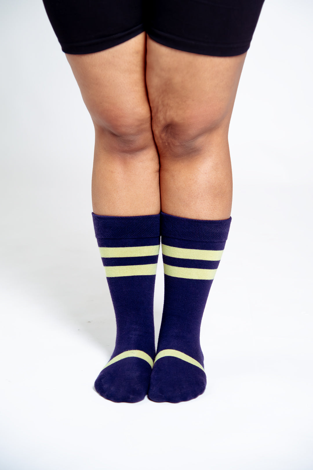 ⁠⁠Sox2 in Eclipse with Green Haze Stripe